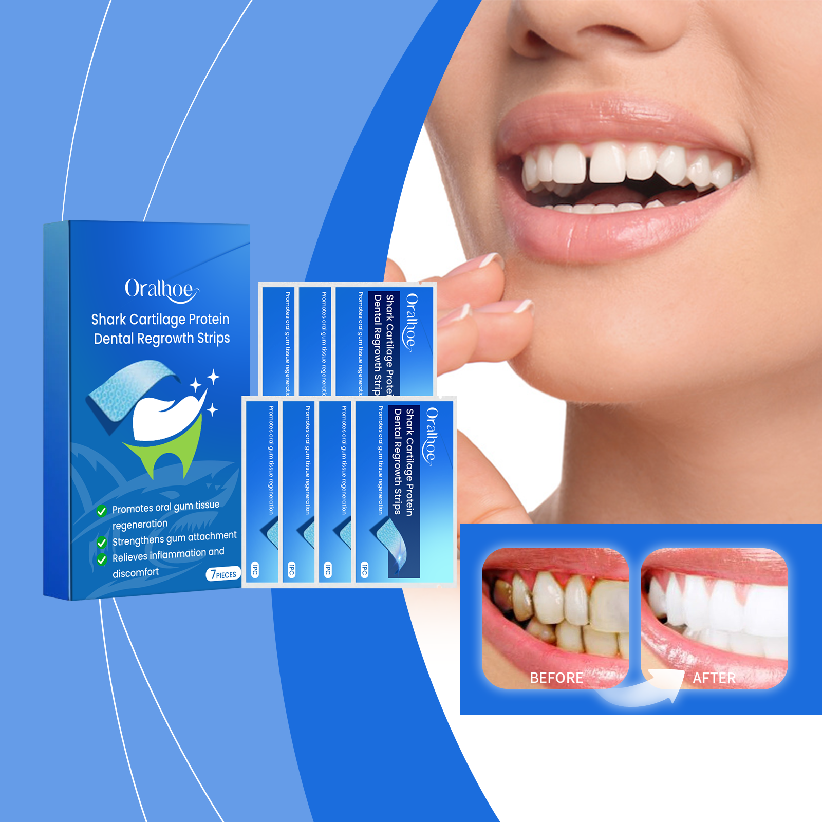 Dental Care And Whitening Strips For Stained Teeth - Image 2